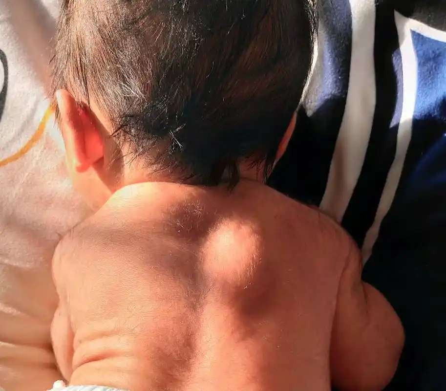 刚出生的宝宝这么多胎毛!能掉吗?正常吗