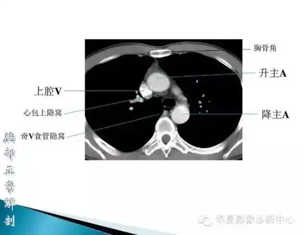 超全胸部ct读片解剖太实用了