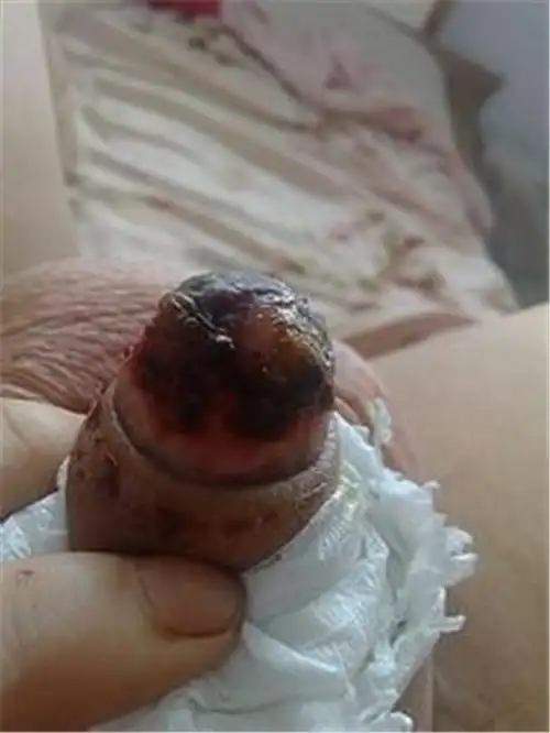 欢喜!医院包生男孩排名"灯火辉煌"-第2张图片-西安论坛资讯