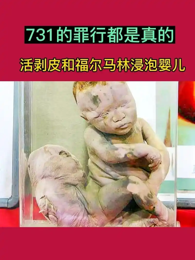 这个日本人它说:我印象最深的就是婴儿标本,真的惨不忍睹,还有 - 抖音