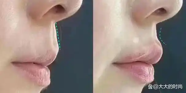 这点很好理解,人中面积被嘴唇占的范围更大,存在感自然变弱.图片