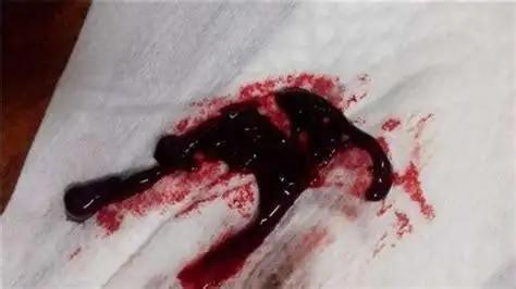 排卵后四天有一点点出血怎么回事