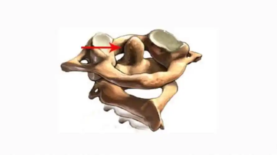 2015主任医生班8寰枢关节_第3页