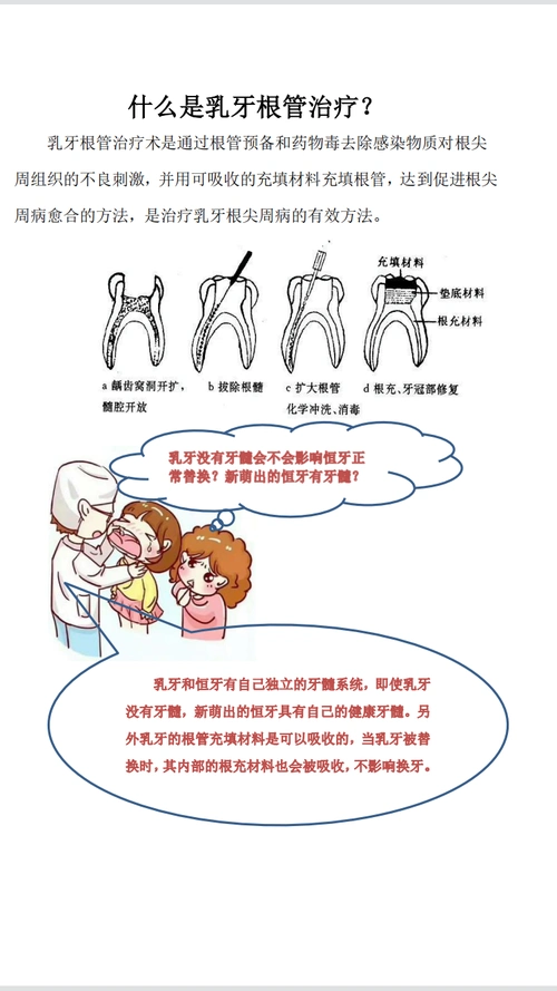 什么是乳牙根管治疗?