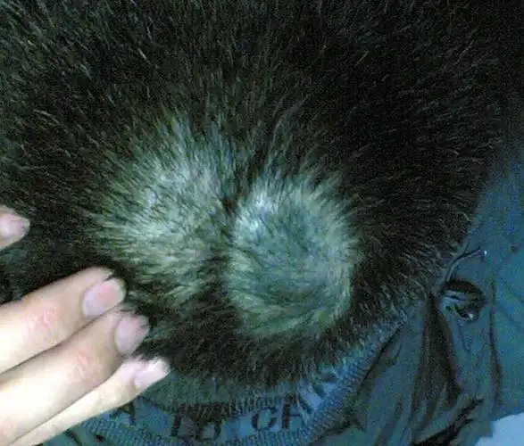 外科医生进来 - 关于头顶黑块