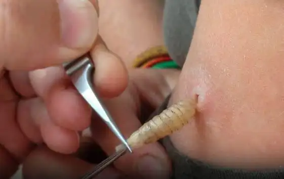 动物篇235虻叮咬重口慎入