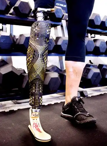 如在过去的10年推动的多功能假肢部件如大腿假肢膝盖,脚和脚踝,虽然