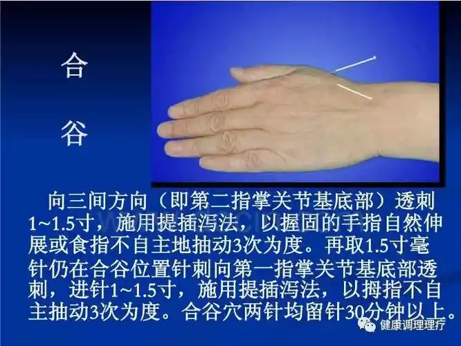 醒脑开窍针法,结合全息经络贯通埋线治疗脑卒中后遗症