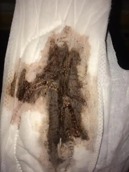 大姨妈今天刚来 是这个颜色的 怎么回事?