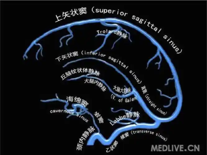 大脑静脉系统解剖课件_第5页
