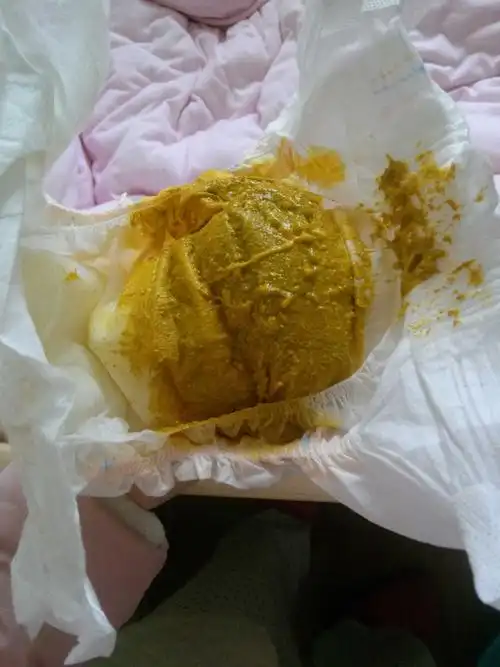 宝宝拉这样的屎粑粑