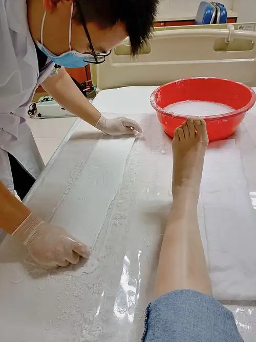 骨科护士带你全程体验,打石膏原来是这样的操作 学术资讯 - 科创中国