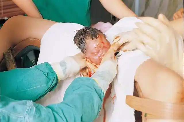 产妇顺产全过程曝光_真人刮宫的手术过程