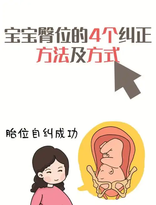 宝宝臀位的4个纠正方法及方式