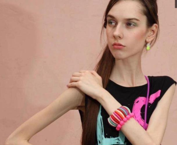 瑞典女孩厌食症瘦的吓人,来到中国进行"食疗",一年之后效果出类拔萃