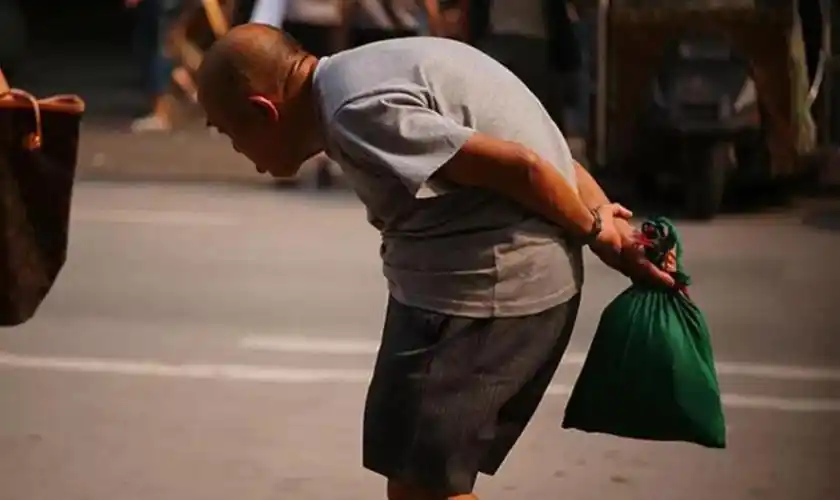 1,心慌 驼背会缩短人胸廓中心3-5厘米的高度,这意味着胸骨会下陷.