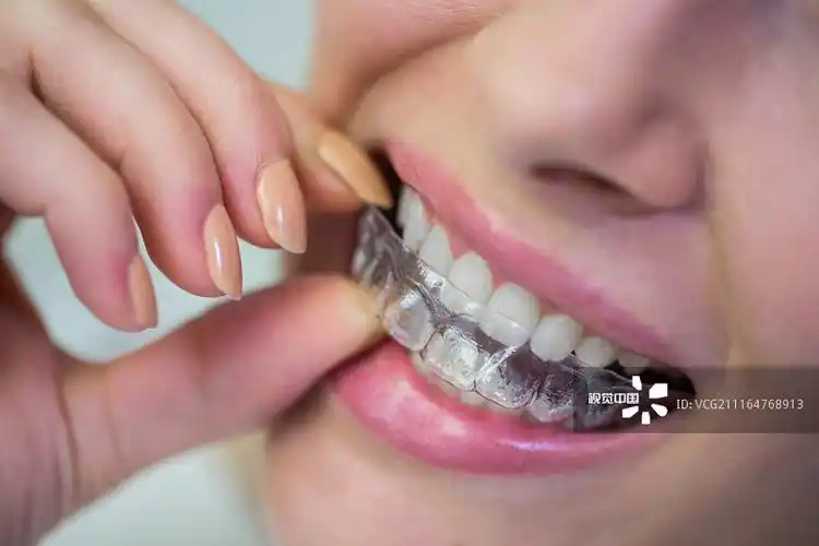戴硅胶隐形矫正牙套的女人