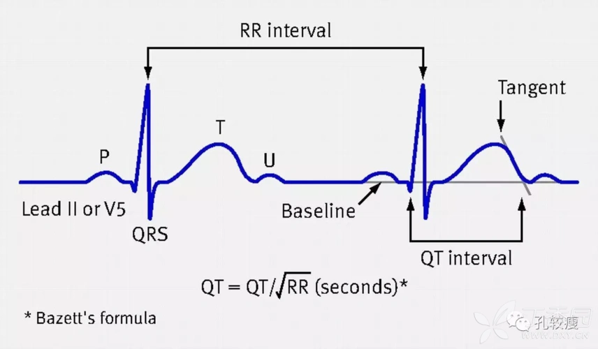 基于rr间期的qt间期校正法,在心律不齐时,获取rr间期会困难