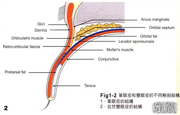 单眼皮与双眼皮解刨学上的不同结构