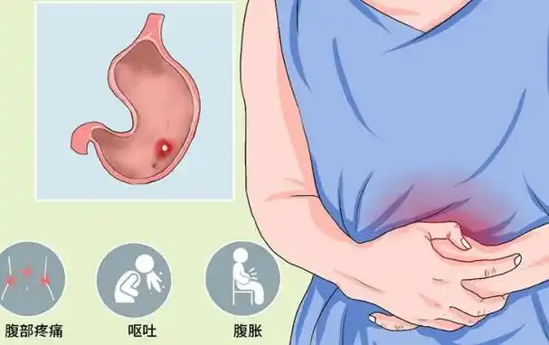 胃病不能吃馒头吗医生建议想要养胃尽量避开这4物