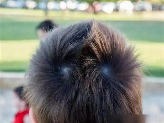 头顶两个漩涡的男孩(男孩子头上两个旋是富贵命吗)