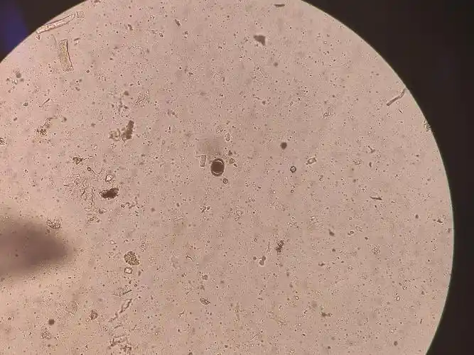 讨论这是蛔虫卵吗有显微镜图