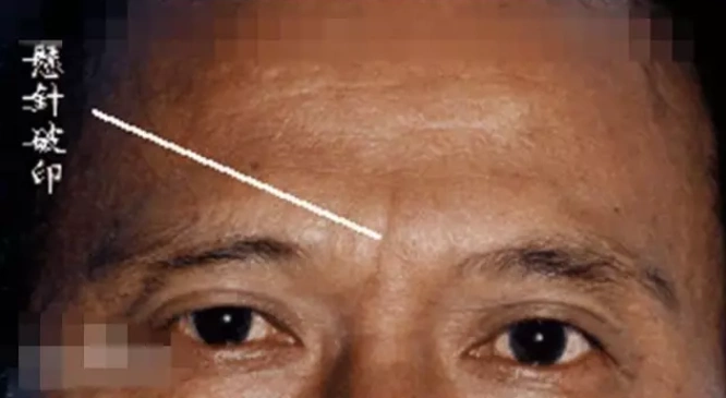 比如说阴骘纹,就是讲人积累了阴德,就会在脸上留下痕迹.