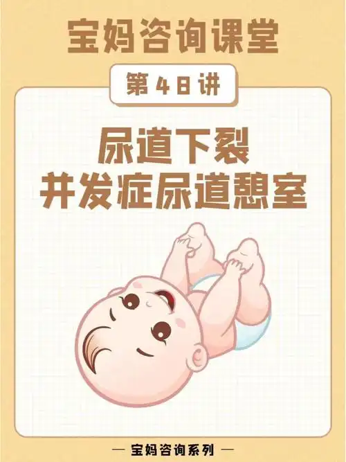 尿道下裂并发症尿道憩室 宝妈必看