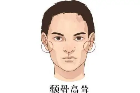 男人颧骨高面相解说