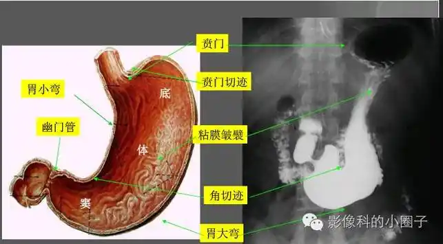 消化道正常影像解剖之——胃