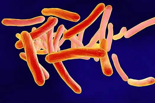 肺结核,显微,风景,模型,细菌,插画,杆菌