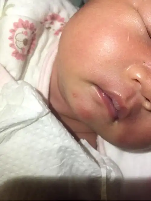 谁知道宝宝嘴巴这是怎么回事