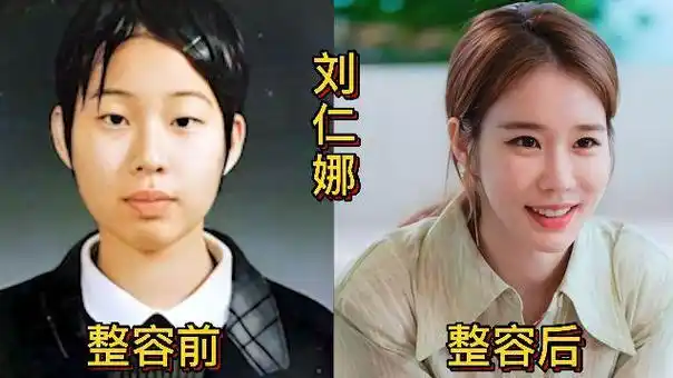 18位韩国女星整容前后对比