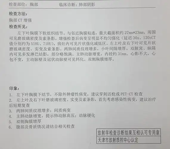 刘懿博士说肺癌(四〇四)pet报两处肺癌为何家属先悲后喜 - 好大夫在线