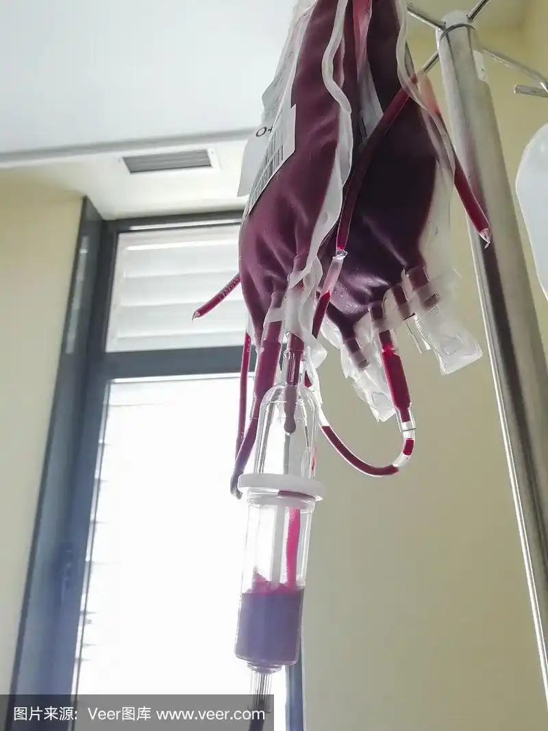 输血用血袋,浓缩红细胞.