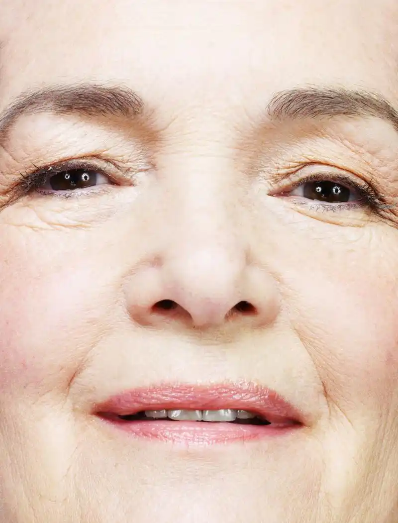 法令纹是随着年龄增长而在面部形成的自然纹路,主要是由于皮肤松弛