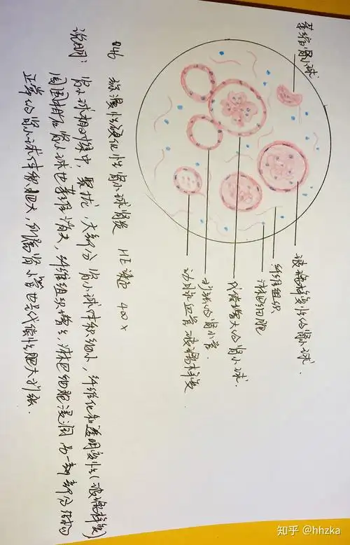 病理学切片红蓝铅手绘图