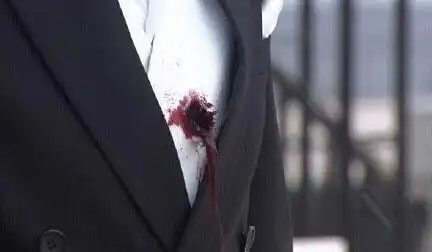 现在的电视剧,中枪后血流这样.