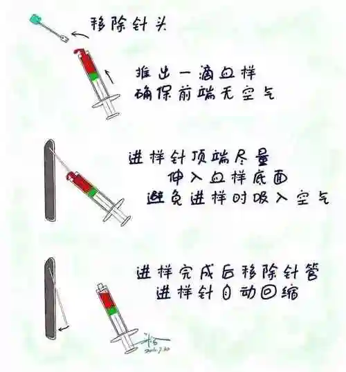 用血气机也是分三步: 第一步:采样 现在一般都是直接用 bd 的血气针