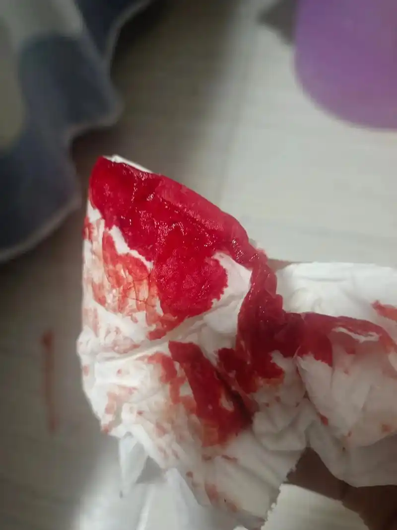 又流鼻血了.去了大医院还是没什么效果我的心都快难过死了