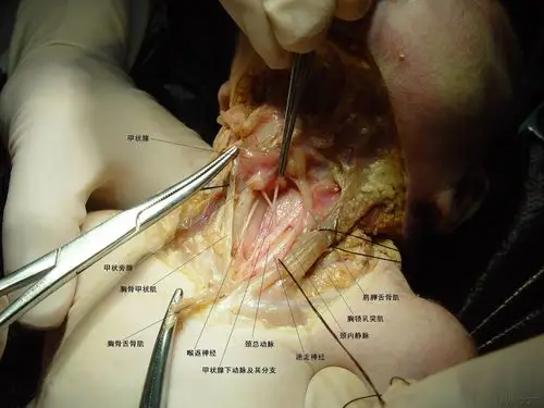 谁与争锋:用新鲜解剖标本自创解剖图谱