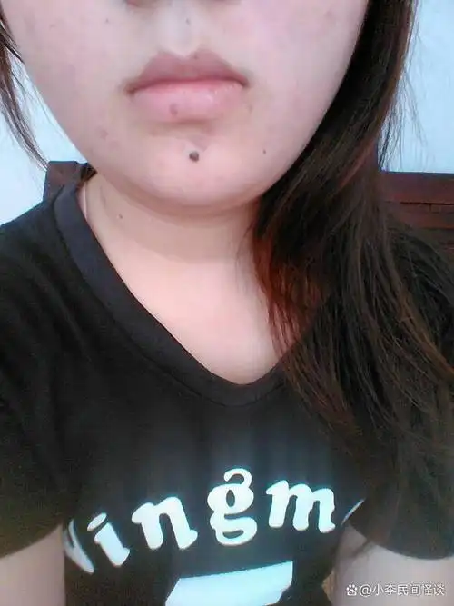 民间怪谈:嘴唇下方美人痣好不好 女人有美人痣好吗