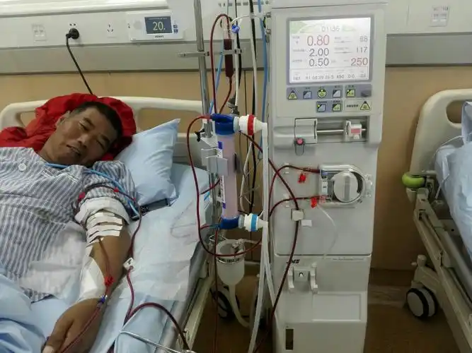 尿毒症患者未置入透析导管---为什么也会出现肿胀手?