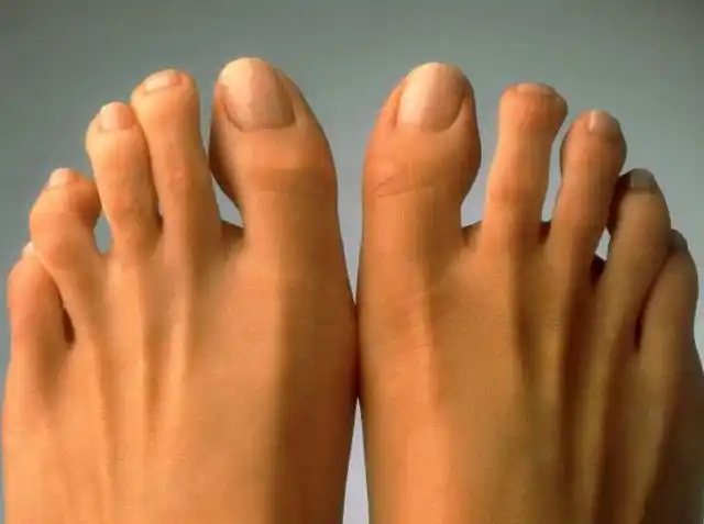 心理测试:4张图,你的脚趾和哪张最像?测你是个什么样的人