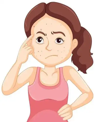 假期赶痘痘的好时机