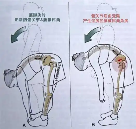 这个动作做不到难怪你总是腰痛