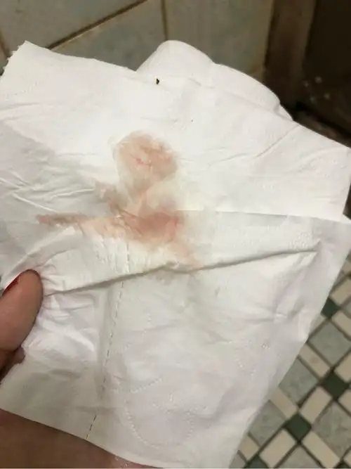 这是月经血吗每天都是这样,上大号的时候擦拭才有点