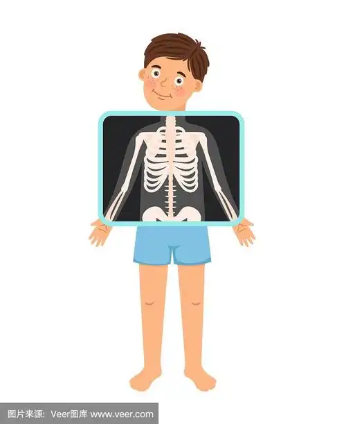 卡通男孩病人x光片