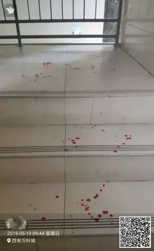 这是一边按着孩子伤口,一边走回家留在楼梯上的血迹