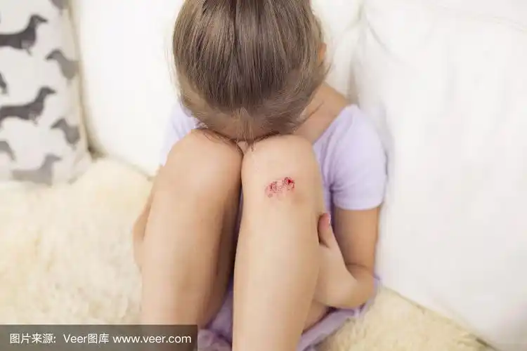 膝盖受伤的伤心女孩.